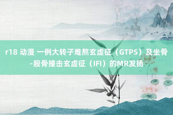 r18 动漫 一例大转子难熬玄虚征（GTPS）及坐骨-股骨撞击玄虚征（IFI）的MR发扬